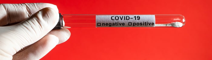 диагноз COVID-19